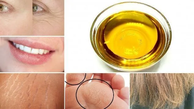 what castor oil is for?